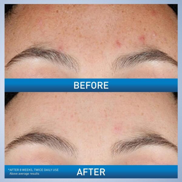 CERAVE Resurfacing Retinol Serum 30 ml - Image 9